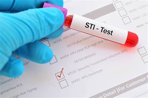 Escort agency to voluntarily test for stds  Let’s explore what that means